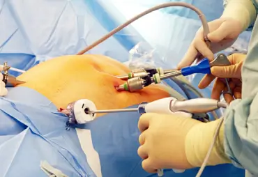 Advanced Gastrointestinal Surgeries image