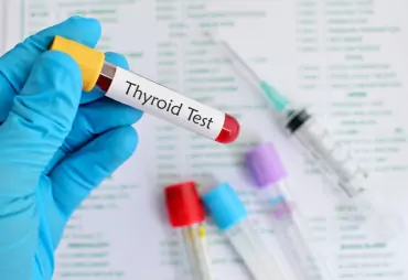 Hormone and Thyroid Testing image