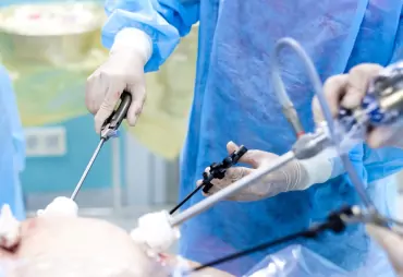 Minimally Invasive Laparoscopic Surgeries image