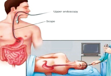 Endoscopy & Colonoscopy