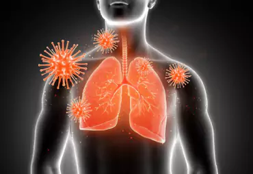 Lung Infections