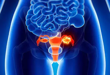 Urological Cancers image